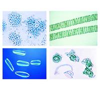 3B Scientific Biology Microscopy Micropräparate Series_ Environment I: Forest: Cause & Effects of Forest Damage