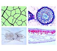 3B Scientific Biology Microscopy Micropräparate Series_ Environment II: Water: Water pollution