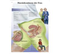 3B Scientific Chart Laminated with Female Urinary Incontinence, 1