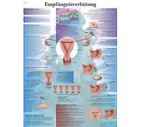 3B Scientific Contraception Educational Chart, Birth Control Methods Anatomy Poster, Female Reproductive Health Teaching Chart