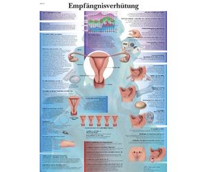 3B Scientific Contraception Educational Chart, Birth Control Methods Anatomy Poster, Female Reproductive Health Teaching Chart