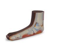 3B Scientific Flat Foot (Pes Planus) Model, dark skin, 3B Smart Anatomy