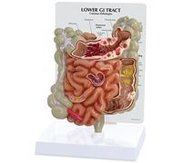 3B Scientific GI Tract Model