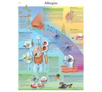 3B Scientific Human Anatomy - Allergies Chart, Laminated Version