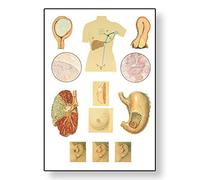 3B Scientific Human Anatomy - Cancer Chart with wooden rods