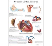 3B Scientific Human Anatomy - Common Cardiac Disorders Chart, Laminated Version