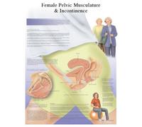 3B Scientific Human Anatomy - Female Urinary Incontinence Chart, Laminated Version