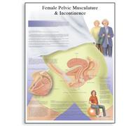 3B Scientific Human Anatomy - Female Urinary Incontinence Chart, Paper Version