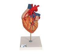 3B Scientific Human Anatomy - Heart Model with Bypass, 2 Times Life Size, 4 Part + free anatomy software - 3B Smart Anatomy