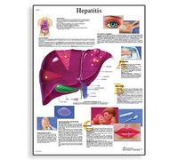 3B Scientific Human Anatomy - Hepatitis Chart, Paper Version