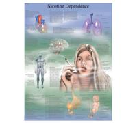 3B Scientific Human Anatomy - Nicotine Dependence Chart, Laminated Version