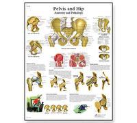 3B Scientific Human Anatomy - Pelvis and Hip Anatomy/Pathology Chart, Paper Version