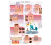 3B Scientific Human Anatomy - Skin Cancer Chart, Laminated Version