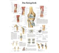 3B Scientific Knee Joint Educational Chart, Knee Anatomy Poster, Ligaments, Meniscus & Pathology Teaching Chart for Medical & Anatomy Education