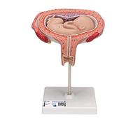 3B Scientific L10/6 5th Month Foetus, Transverse Lie + anatomy software - 3B Smart Anatomy