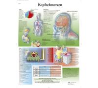 3B Scientific Laminated Chart - Headache