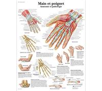 3B Scientific - Laminated Osteoarthritis Chart - UV & Dust-Protected Anatomy & Pathology Poster for Study, Teaching & Clinics