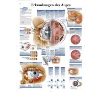 3B Scientific Lehtrafel - Eye Diseases, 1