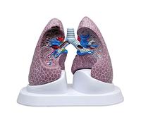 3B Scientific Lung Set with Pathologies