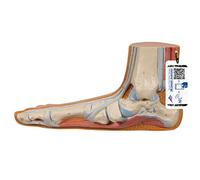 3B Scientific M31 Flat Foot, Pes Planus + free Anatomy App - 3B Smart Anatomy
