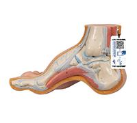 3B Scientific M32 Hollow Foot, Pes Cavus + free anatomy software - 3B Smart Anatomy