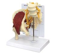 3B Scientific Muscled Hip with Sciatic Nerve