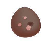 3B Scientific® Sonotrain Breast Model with Cysts - Dark Skin Ultrasound Breast Simulator for Cyst Detection & Diagnostic Training