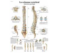 3B Scientific Spine Anatomy and Pathology Educational Chart, Human Vertebral Column Poster, Spanish Anatomy Wall Chart, Medical Teaching Aid, 50 x 67 cm