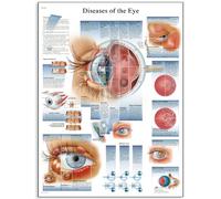3B Scientific VR1231UU Human Anatomy - Diseases of the Eye Chart, Paper Version, unlaminated