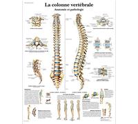 3B Scientific VR2152UU Anatomical Chart "La Colonne Vertébrale, Anatomie et Pathologie", Paper Version