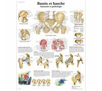3B Scientific VR2172UU Anatomical Chart "Bassin et Hache - Anatomie et Pathologie", Paper Version