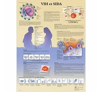 3B Scientific VR2725L "HIV et SIDA" Anatomical Board