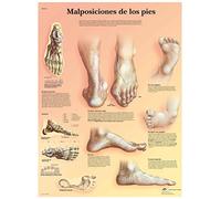 3B Scientific VR3185L "Lesiones deportivas" Printed in Paper