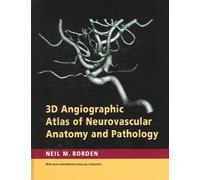 3D Angiographic Atlas of Neurovascular Anatomy and Pathology