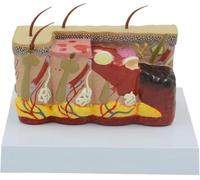 3D Burned Skin Model, Pathological Skin Anatomy Model, Durable PVC Material and Detailed Structure, Human Anatomical Model, for Visual Teaching Aid, Study Tool.