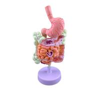 3D Cutaway Pathology Model, Pathological gastroi