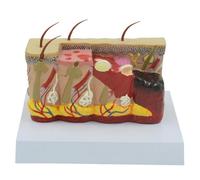 3D Human Skin Anatomy Model - Detailed Burned Skin PVC Model for Visual Teaching, Study Aid & Educational Tool - Durable & Realistic Structure for Anatomy Learning