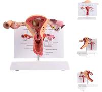 3D Human Uterus Model Uterus Model Ovary Model Human Anatomy Anatomy of The Female Reproductive System Replica Anatomy for Physicians Educational Tool