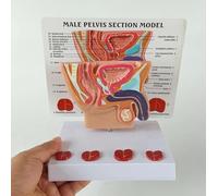 3D Prostate Model Human Male Abdominal Bladder and Prostate Model Healthy and Sick Medical Teaching Doctor-Patient Explanation Model, for Hospital and Training Display