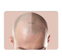 3PCS/Pack Scalp Micropigmentation Practice Skin - Printed SMP Tattoo Training Pad for Hairline Design & Dot Work - Ideal for Beginners & Artists (3PCS Design #4)