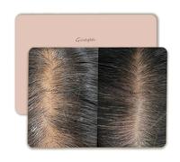 3PCS/Pack Scalp Micropigmentation Practice Skin - Printed SMP Tattoo Training Pad for Hairline Design & Dot Work - Ideal for Beginners & Artists (3PCS Design #3)