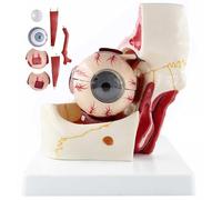 3X Enlarged Human Eye Orbital Anatomical Model, 10 Parts Detachable Eyeball Model Showing Optic Nerve Cornea Iris Lens and Vitreous Body