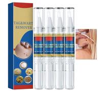 4 PCS Wart Remover Pen,Tags and Mole Remover Pen,Skin Tag Rem/Over Kit,2 in 1 Wart and Wart Treatment,Wart-Remover Liquid,Foot&Hand Wart Strong Remover,Fast Acting Mole Removal for All Type Skins,3ml