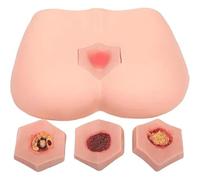 4 Stages of Bedsores Pressure Sore Simulator Nursing Model, Decubitus Wound Care Model for Medical Training Practice