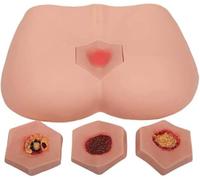 4 Stages Pressure Sore Simulator Nursing Model, Bedsores Ulcer Care Model, Wound Care Educational Tool for Medical Practice Training