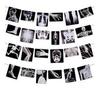 4 Strings X-Ray Skeleton Banner Decorations, Pre-Strung Medical Radiology Anatomy Garland with 24 X-Ray Body Part Images for Doctor Nurse Graduation, Halloween Party, Clinic Classroom Science Décor
