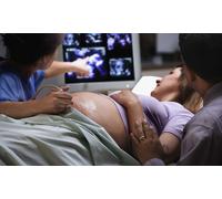 4D Baby Scan with Digital image and Prints