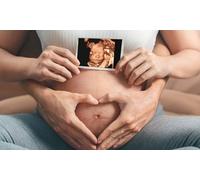 4D Gender Scan 14 - 24 Weeks