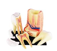 4D Vision Dental Teeth Model,Tooth Model, 23 Detachable Organs Human Teeth Anatomy Model Puzzle Toy for Medical Educational Training Aid