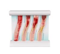 4Pcs Human Dynamic Vascular Model,Artery Disease Model，Demonstrates Atherosclerosis,Plaque Buildup And Blood Flow Viscosity,for Medical Student Patient Education